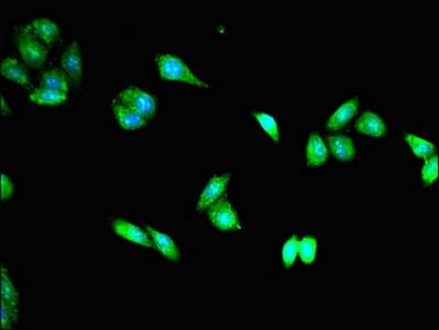 ERIC-1 / TACC3 Antibody