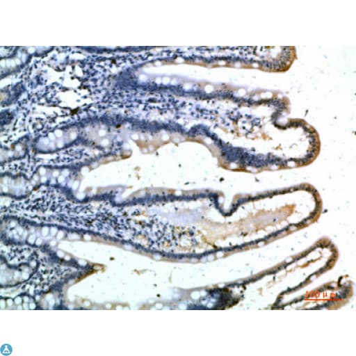 SELE / CD62E / E-selectin Antibody