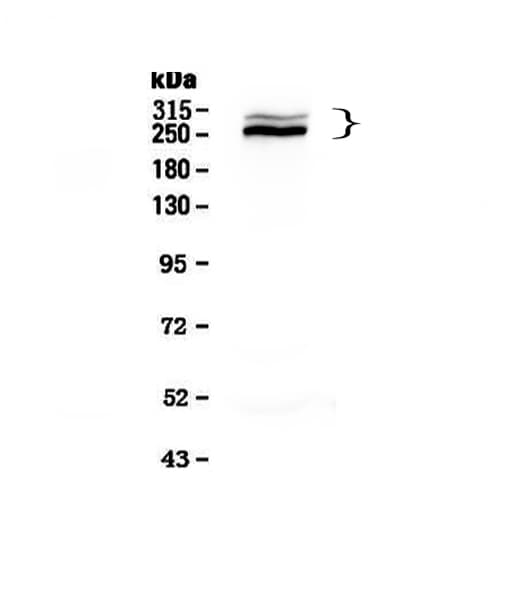 DSP / Desmoplakin Antibody