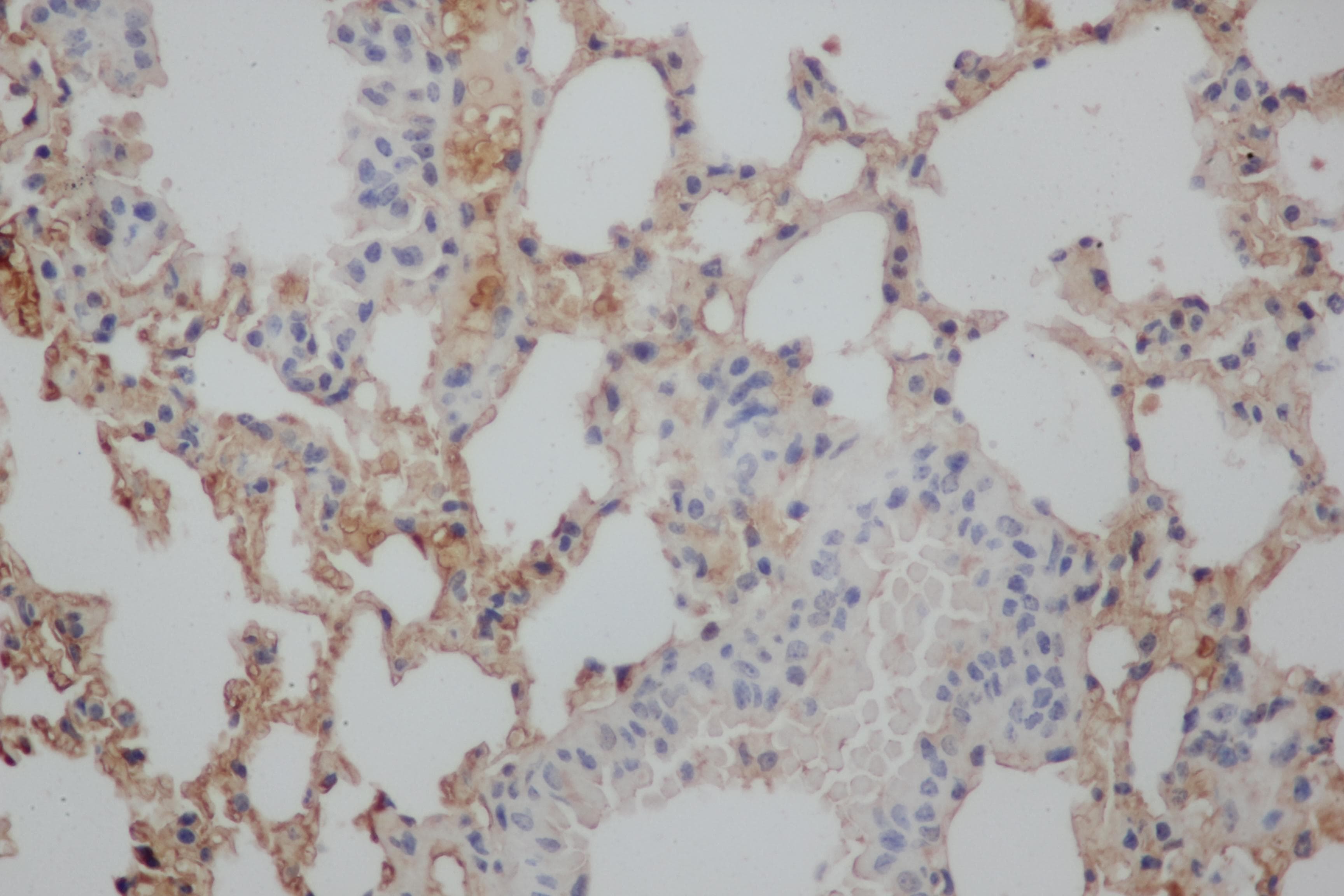 APP / Beta Amyloid Precursor Antibody