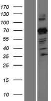 ZNF746 / PARIS Protein (Over-Expression Lysate Myc-DDK (Flag))
