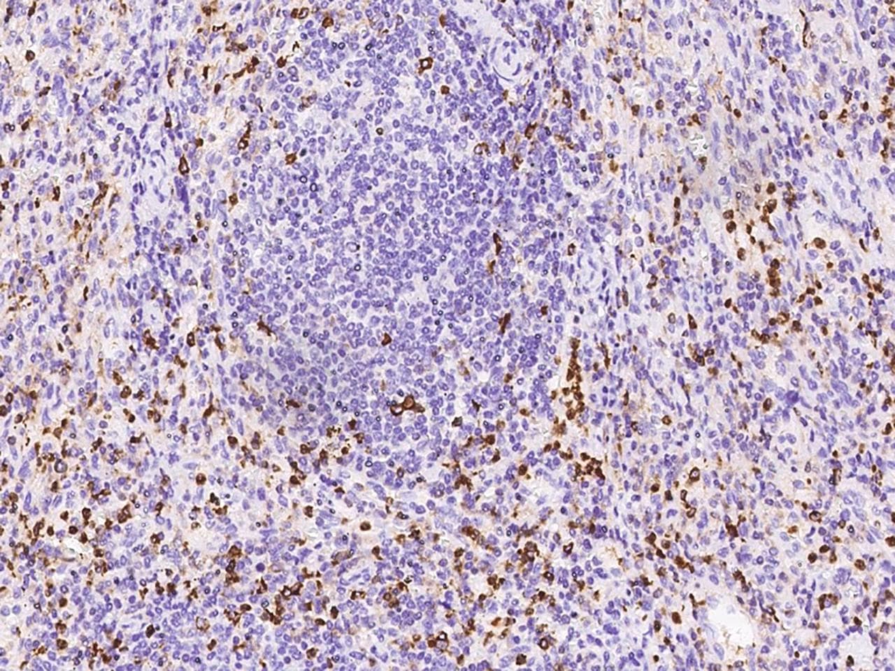 Polyclonal Rabbit anti-Human APOBR / APOB48R Antibody (IHC)