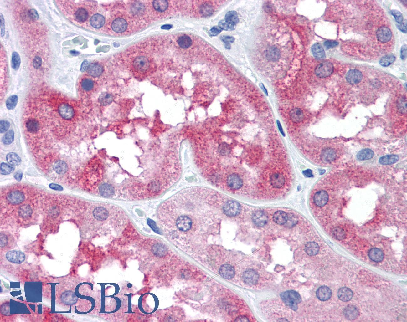 IHC-plus™ MAPT / Tau Antibody (Ser404)