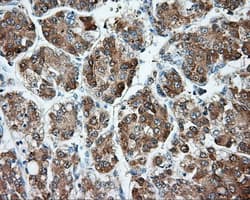 HMRF1L / MTRF1L Antibody (clone OTI2H8)