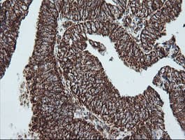 NDUFB10 Antibody (clone OTI4F1)