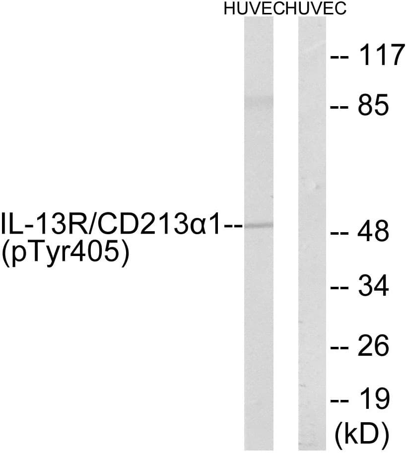 IL13RA1 / IL13R Alpha 1 Antibody (phospho-Tyr405)