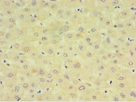 CYP2J2 Antibody (aa328-502)
