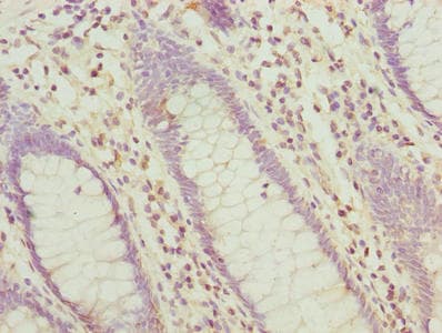 HABP2 Antibody (aa314-560)