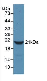 FGA / Fibrinogen Alpha Antibody (aa77-244)
