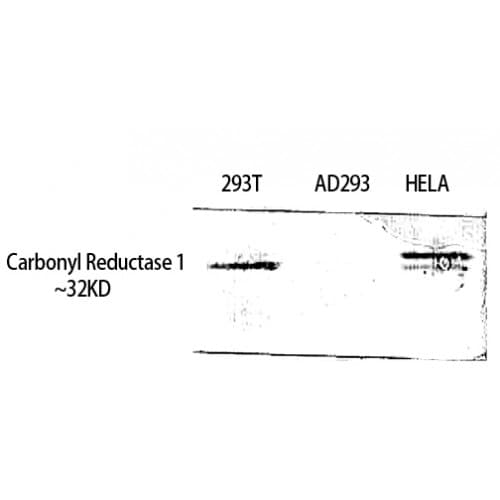 CBR / CBR1 Antibody (150-230 aa, Internal)