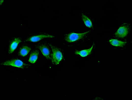 Polyclonal Rabbit anti-Human DOK3 Antibody (IHC, IF, WB)