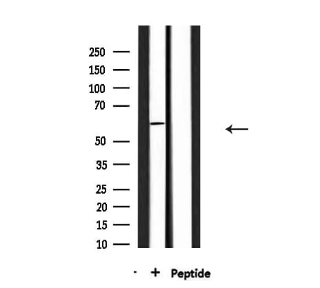 Polyclonal Rabbit anti-Human SGOL1 / Shugoshin Antibody (WB)
