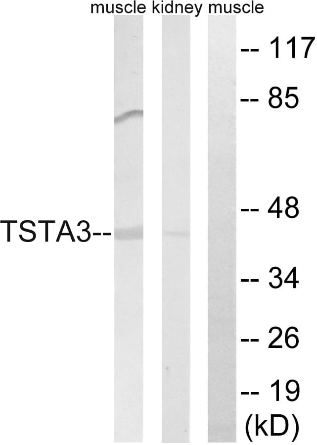 IHC-plus™ Polyclonal Rabbit anti-Human TSTA3 / GDP-L-Fucose Synthase Antibody (aa221-270, IHC, WB)