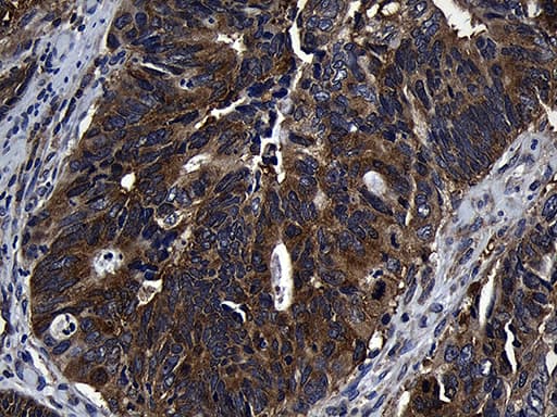 Monoclonal Mouse anti-Human ZFYVE1 / DFCP1 Antibody (clone OTI4B3, aa1-308, IHC, WB)
