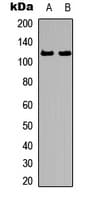AR / Androgen Receptor Antibody (phospho-Ser213)