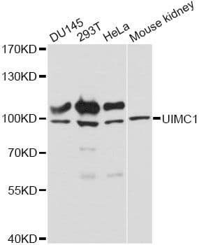 UIMC1 / RAP80 Antibody