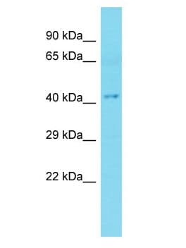 Polyclonal Rabbit anti-Human HENMT1 Antibody (aa278-327, WB)
