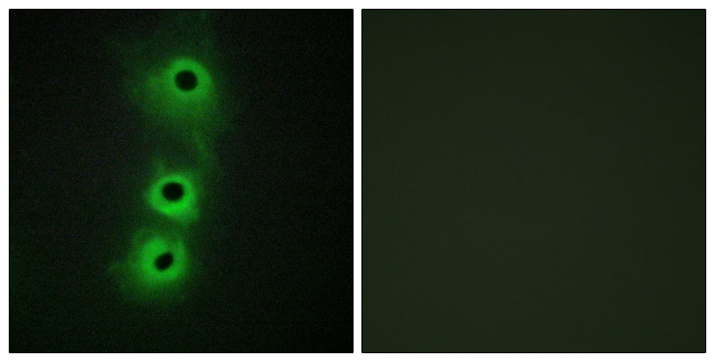 Polyclonal Rabbit anti-Human CDH8 / Cadherin 8 Antibody (aa491-540, IHC, IF, WB)