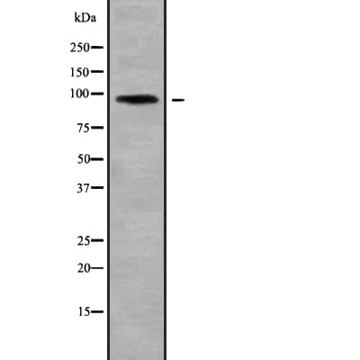Band 4.1 / EPB41 Antibody