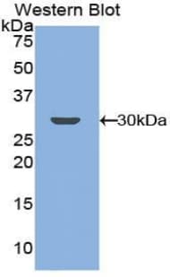 GRK5 Antibody (aa304-532)