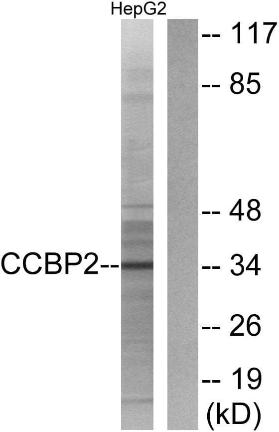ACKR2 / CCR10 / D6 Antibody