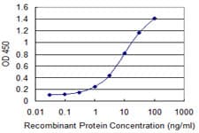 IHC-plus™ Monoclonal Mouse anti-Human CCS Antibody (clone 1E2, IHC, WB)