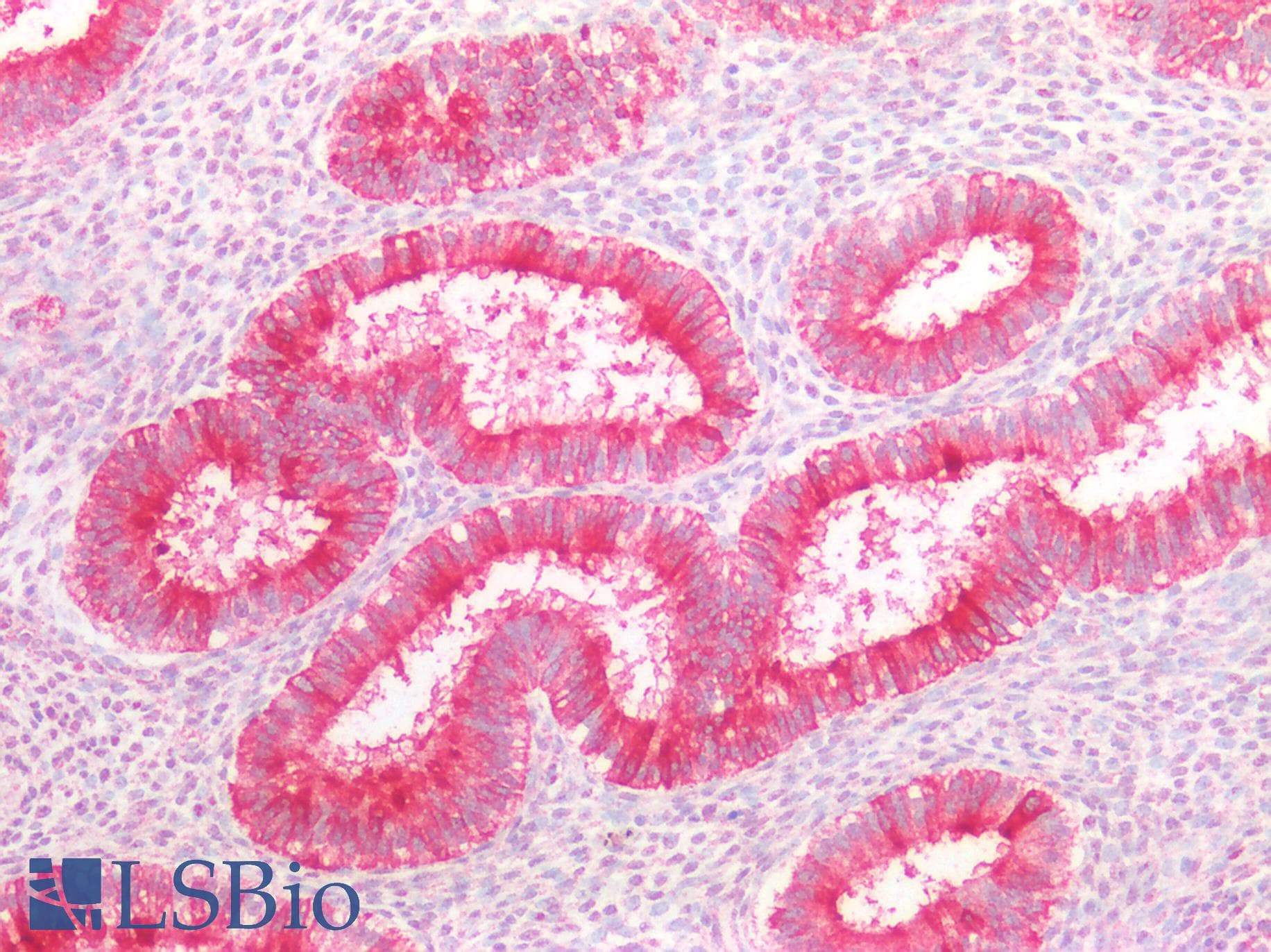 IHC-plus™ EMA / MUC1 Antibody