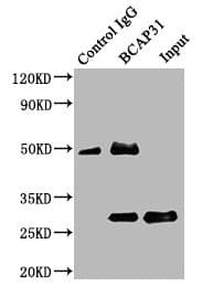 IHC-plus™ BCAP31 / BAP31 Antibody (aa 2-234)