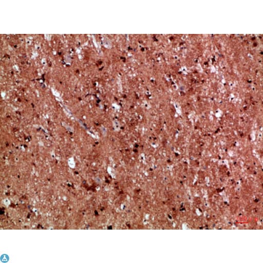 IL17D Antibody