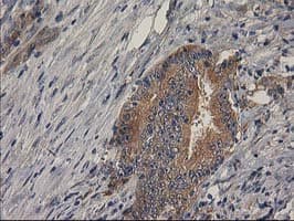 BCAR1 / p130Cas Antibody (clone OTI1A9)