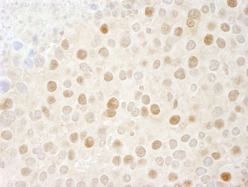 CDK2 Antibody (aa248-298)
