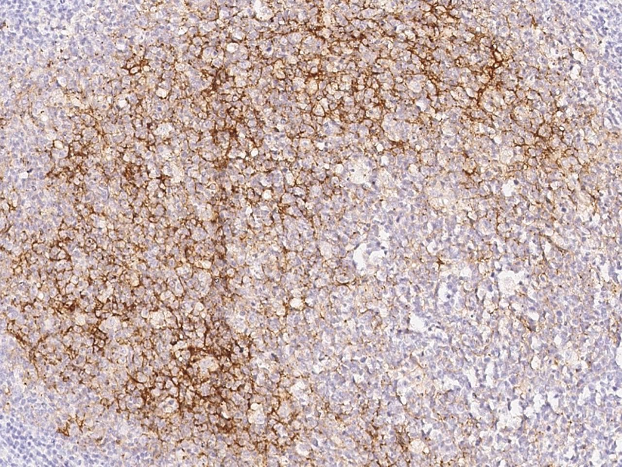 CD14 Antibody (clone 17, Preservative Free)