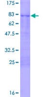 Human CBX8 Protein (Recombinant GST)