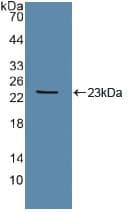 TEK / TIE2 Antibody (aa286-465)
