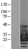 PMP22 Protein (Over-Expression Lysate Myc-DDK (Flag))
