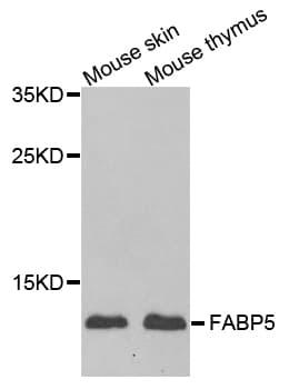 Polyclonal Rabbit anti-Human E-FABP / FABP5 Antibody (IF, WB)