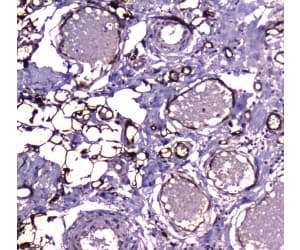 E-FABP / FABP5 Antibody