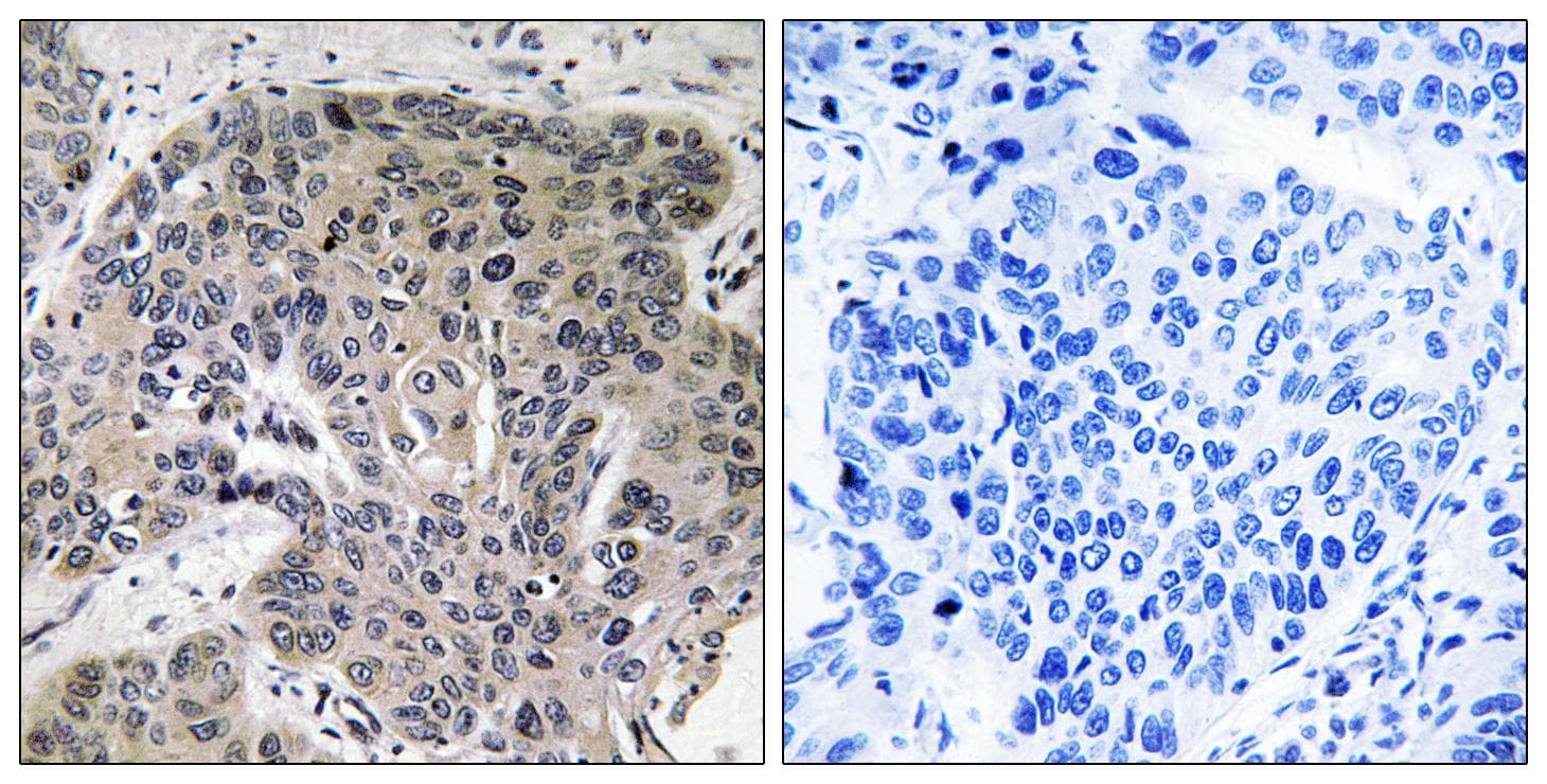 S100A3 / S100E Antibody