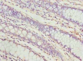 PECR Antibody