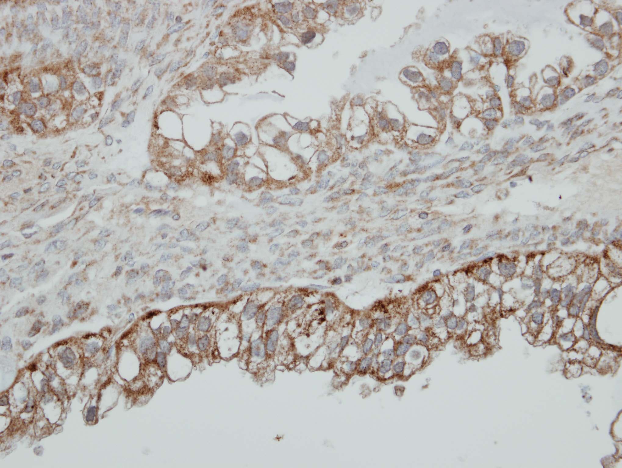 HSD17B4 Antibody (aa18-261)