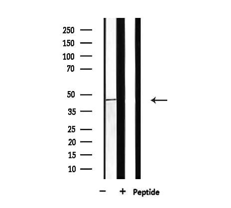 BCKDK Antibody