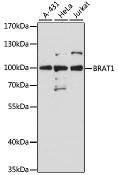 BRAT1 / BAAT1 Antibody