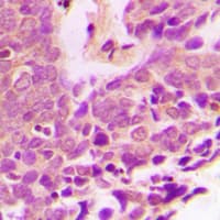 XIAP Antibody (Internal)