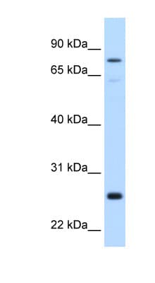 Polyclonal Rabbit anti-Human GSTM2 Antibody (aa71-120, IHC, WB)