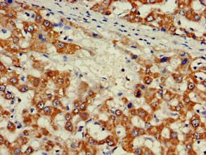 Polyclonal Rabbit anti-Human ZNF816 / ZNF816A Antibody (IHC, IF)