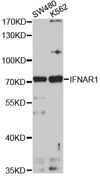 IFNAR1 / IFNAR Antibody