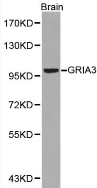 Polyclonal Rabbit anti-Human GRIA3 / GLUR3 Antibody (IHC, WB)