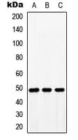 Polyclonal Rabbit anti-Human BMP10 Antibody (Internal, WB)