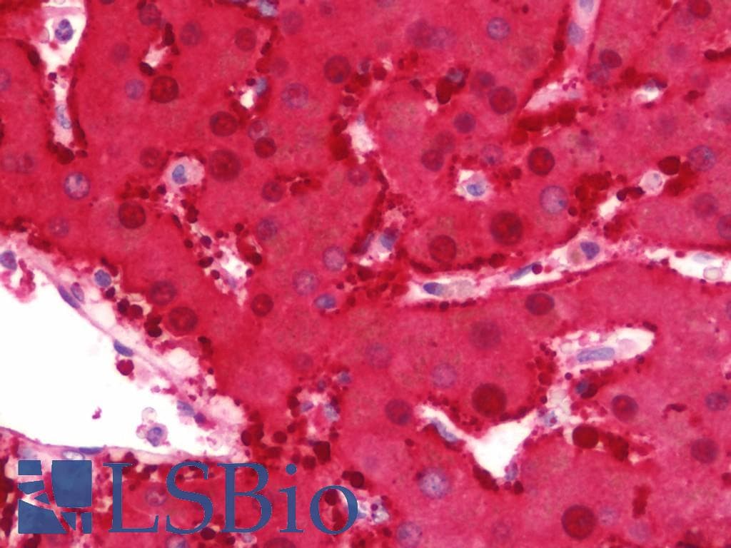 IHC-plus™ DDH / AKR1C1 Antibody (aa22-248)