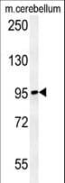 NAA25 Antibody (aa720-748)